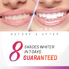 Accelerator Teeth Whitening Kit Image