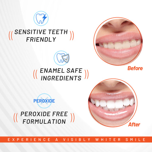 Activated Charcoal Deep Stain Remover Whitening Strips Image