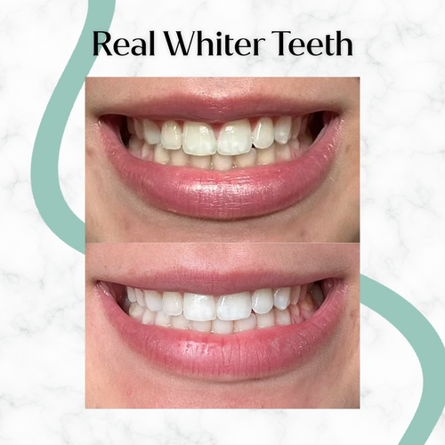 Professional White Whitening Toothpaste Image 