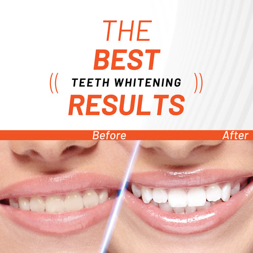 Activated Charcoal Teeth Whitening Powder Image 