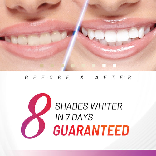 Accelerator Teeth Whitening Kit Image 